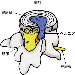 主な治療方法 | 医療法人 慈和会 吉田整形外科病院