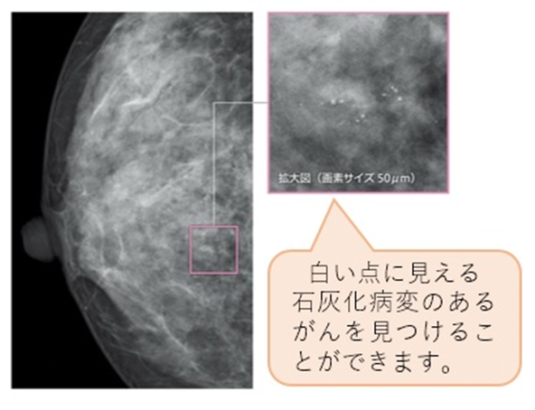 マンモグラフィ検査室 | 診療科・部門紹介 | 岡崎市民病院