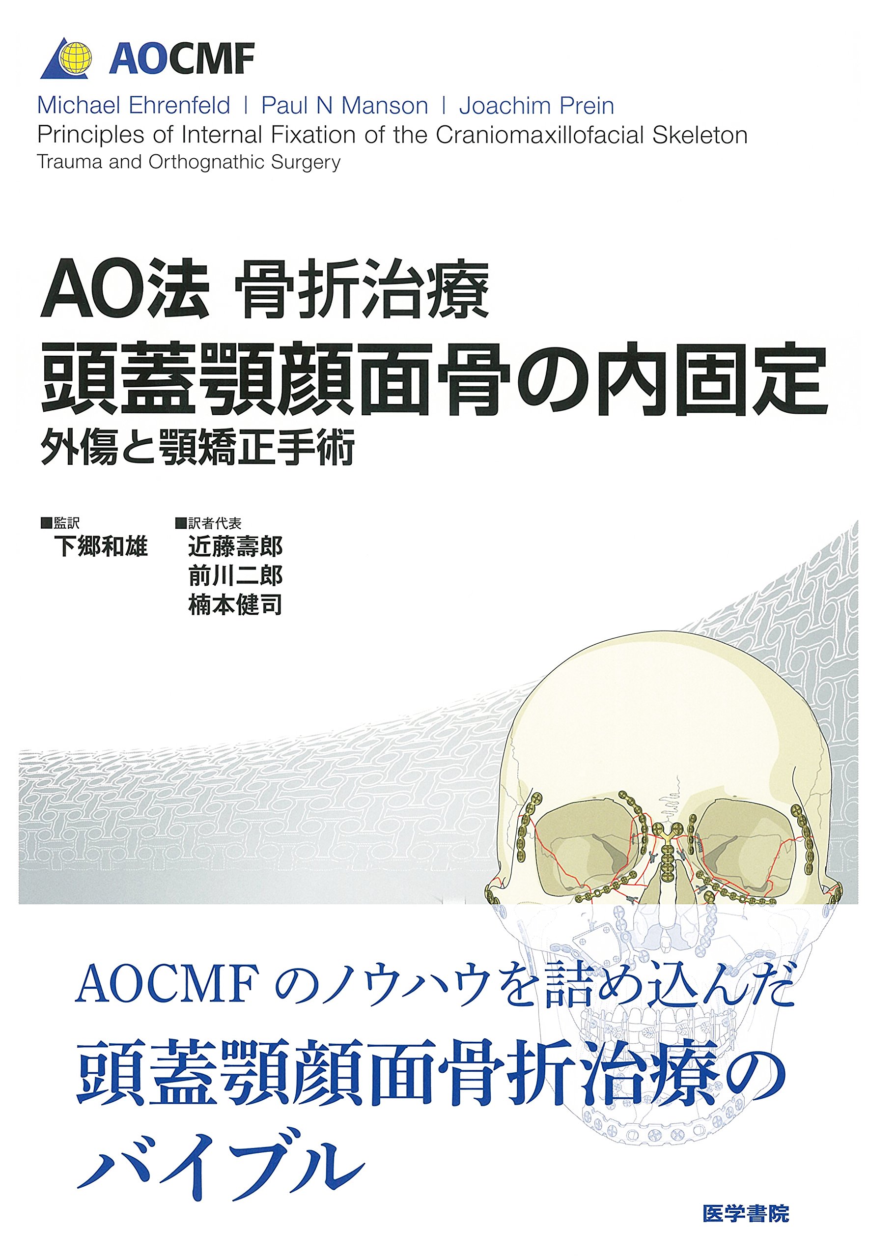 AO法骨折治療 頭蓋顎顔面骨の内固定: 外傷と顎矯正手術 | 下郷和雄